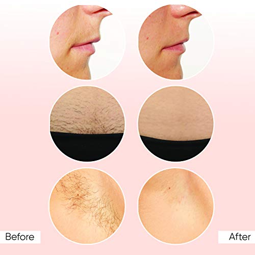 Sensica Sensilight Mini Permanent Hair Removal Device for Men & Women, Advanced RPL Technology System Painless Kit, Hairless Body, Face & Skin - Image 2